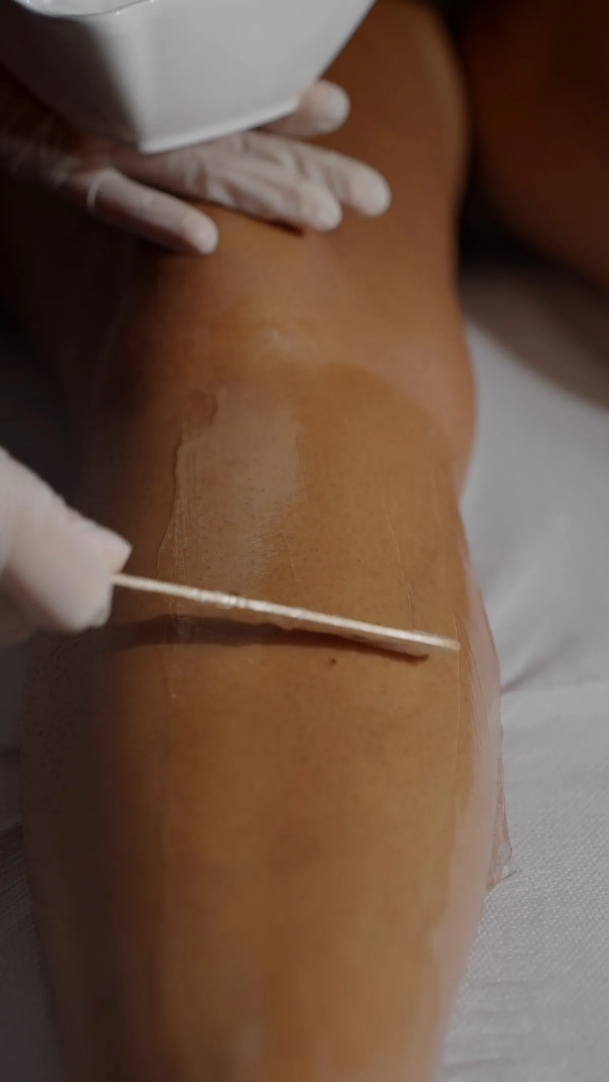 Gel steso sulla gamba per preparare la pelle alla seduta di epilazione laser